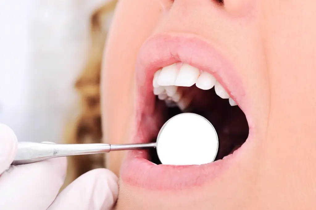 tipos de manchas en los dientes