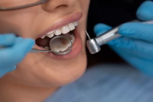 Dientes mostrando el material con el que se hacen los implantes dentales