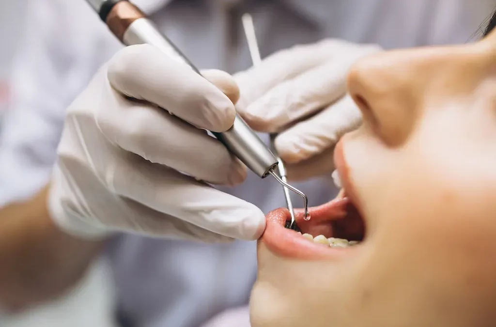 ¿Qué es una endodoncia?