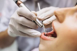 Que es una endodoncia