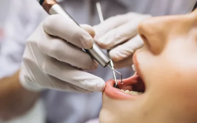 ¿Qué es una endodoncia?