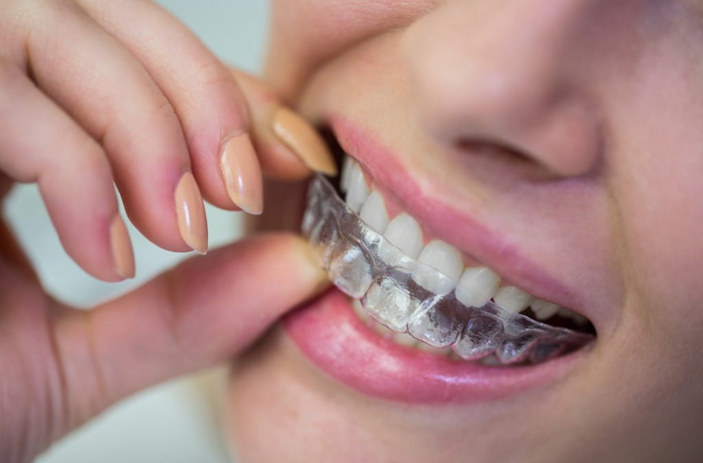 ¿Retirarse la ortodoncia invisible duele?