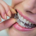 ¿Retirarse la ortodoncia invisible duele?