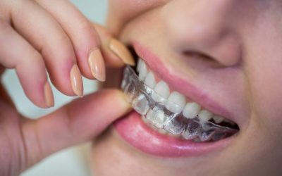 ¿Retirarse la ortodoncia invisible duele?