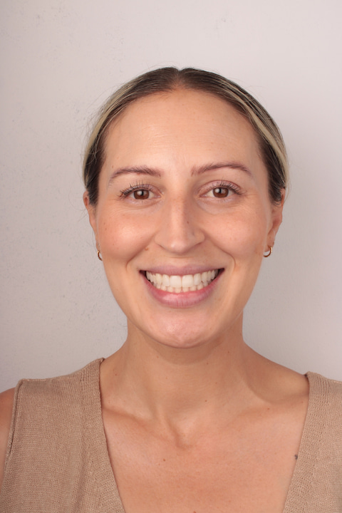 estetica dental en arroyomolinos