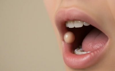 ¿Qué es un fibroma oral? Causas, síntomas y tratamiento