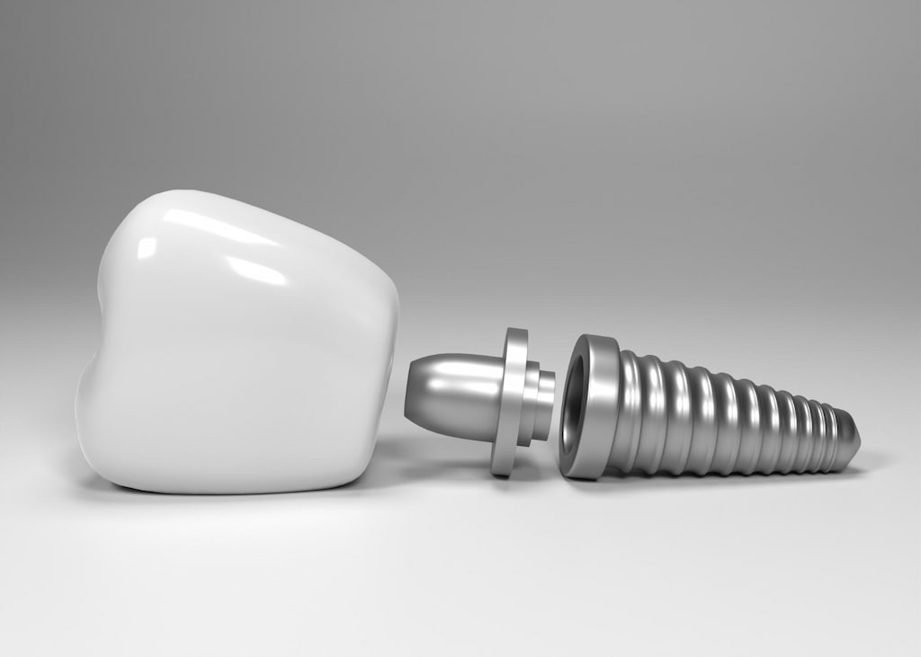 estetica dental en arroyomolinos