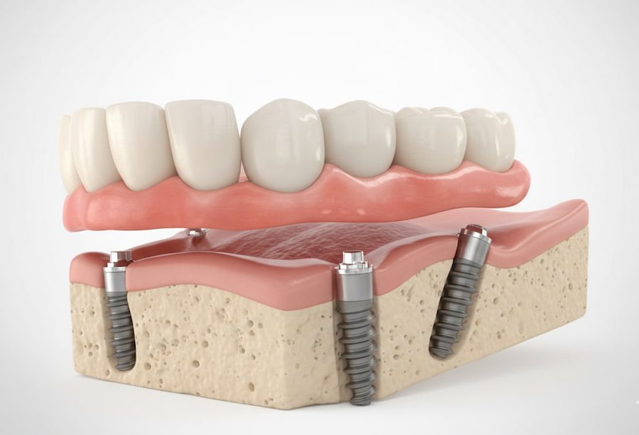 estetica dental en arroyomolinos