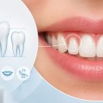 Microdoncia: qué es, causas y tratamientos