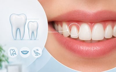 Microdoncia: qué es, causas y tratamientos