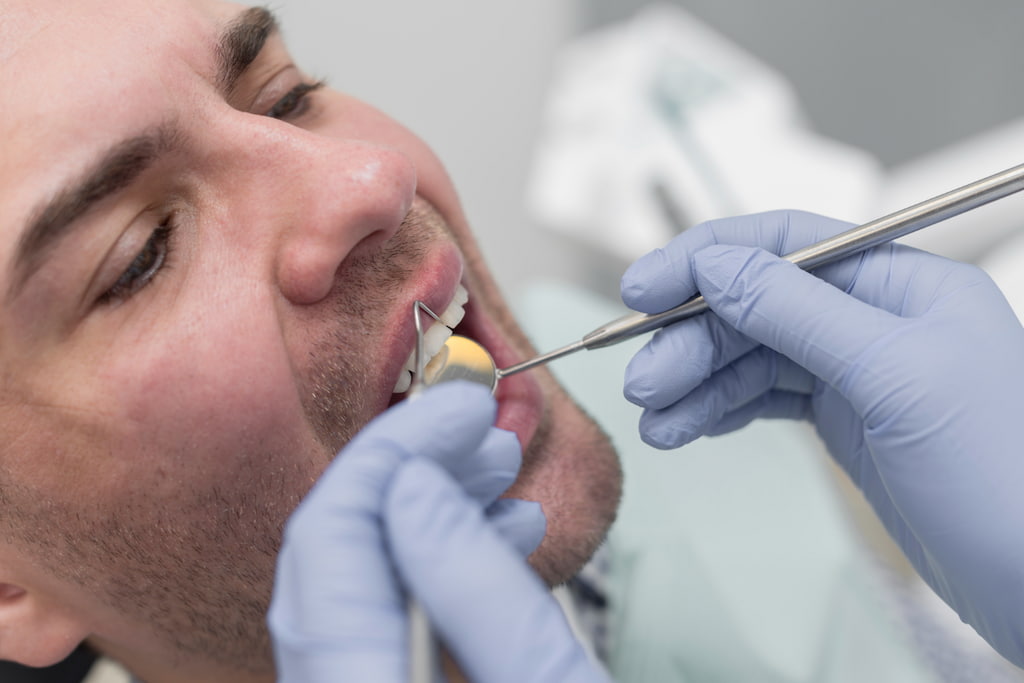 stripping dental que es